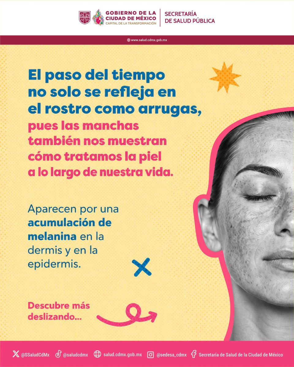SSaludCdMx's tweet photo. Cada 25 de mayo conmemoramos el Día Internacional de las Manchas Cutáneas. En esta fecha, te contamos todo lo que debes saber sobre ellas.
¡Mándale esta info a quien sabes que le falla protegerse del sol para que prevenga manchas cutáneas!
#Efeméride #Prevención #YoMeCuido https://t.co/PYEEEWYqEr