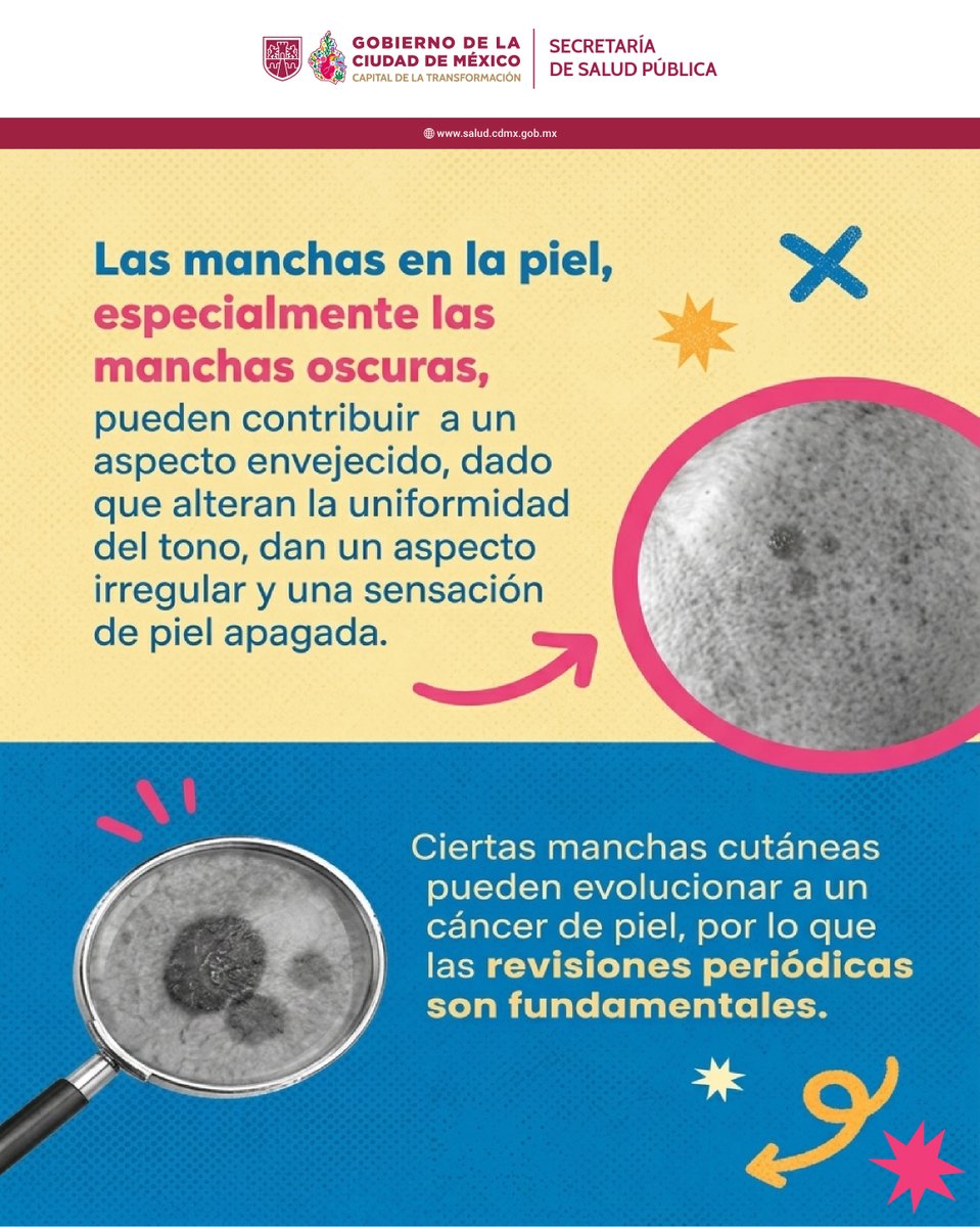 SSaludCdMx's tweet photo. Cada 25 de mayo conmemoramos el Día Internacional de las Manchas Cutáneas. En esta fecha, te contamos todo lo que debes saber sobre ellas.
¡Mándale esta info a quien sabes que le falla protegerse del sol para que prevenga manchas cutáneas!
#Efeméride #Prevención #YoMeCuido https://t.co/PYEEEWYqEr