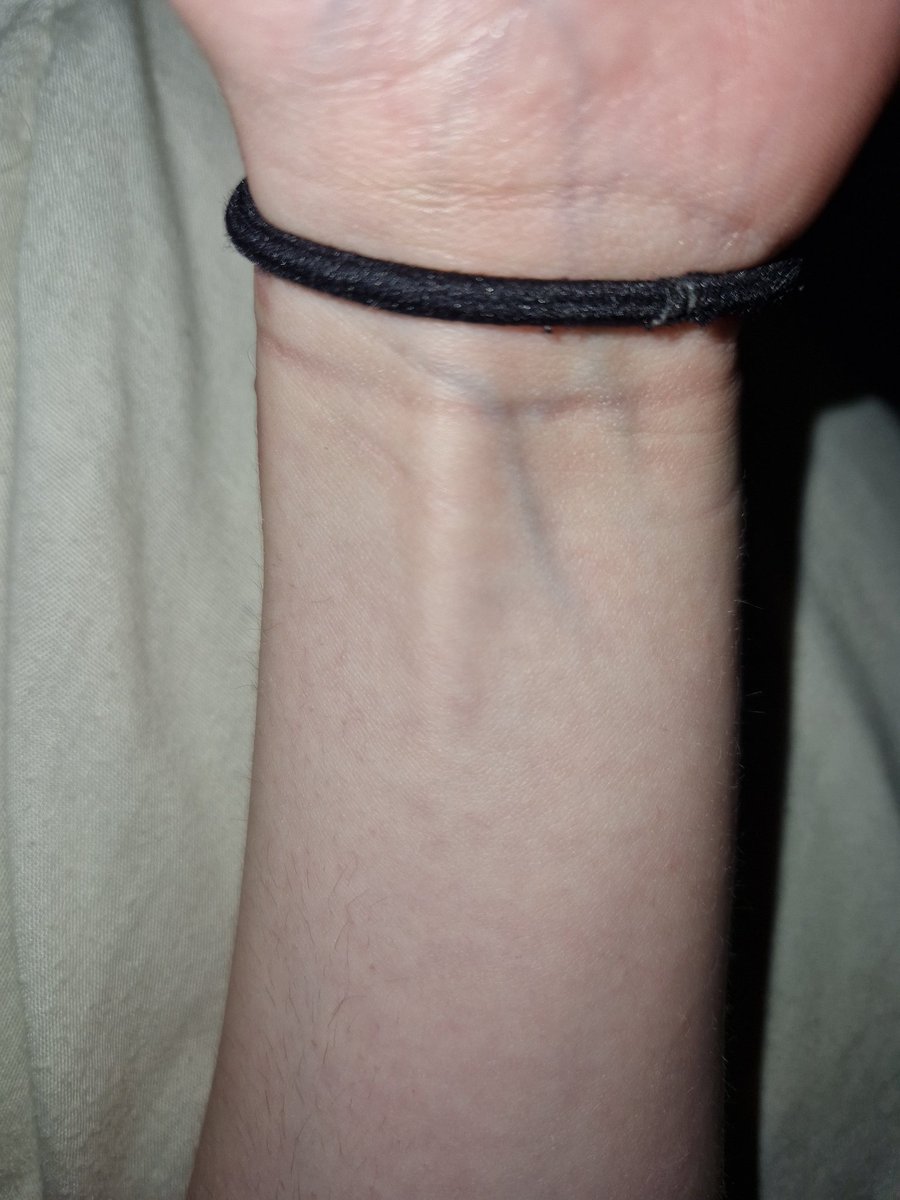 bloomingjuniper's tweet photo. the tendon is looking at you 👀 https://t.co/kiyTV1OnTK