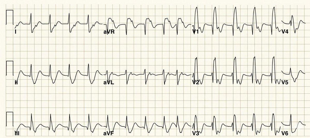 CardiovascularCorner tweet media