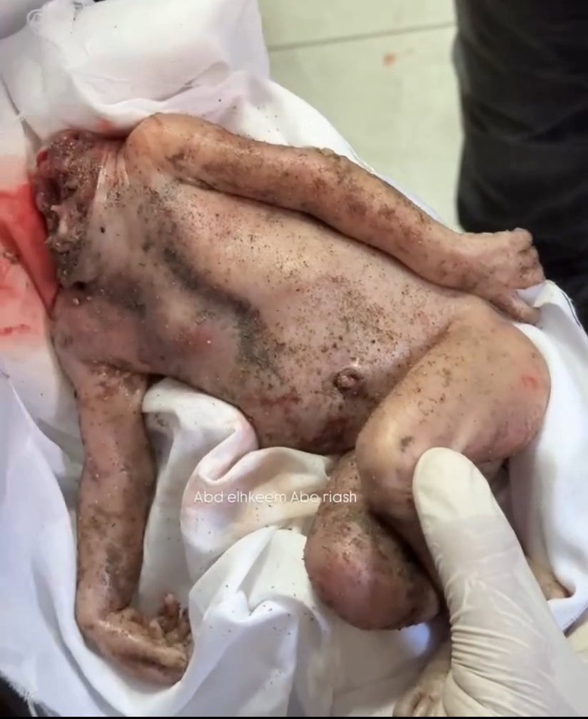 Eyes Of Gaza tweet media