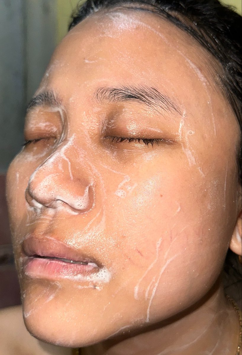 vnyfe's tweet photo. Apa itu Sebaceous filament sejak pake ini 👇
Dermalogica Daily Microfoliant 

Cara cepet satset hempas komedo, exfoliasi wajah cuma pakai bubuk di-air-in terus aman digunain tiap hari pula😌❤️

Buruan checkout sekarang🫵 https://t.co/T2Ab6cbBEQ

#DermalogicaID #NoiseOffResultsOn https://t.co/yBJPurmvBJ