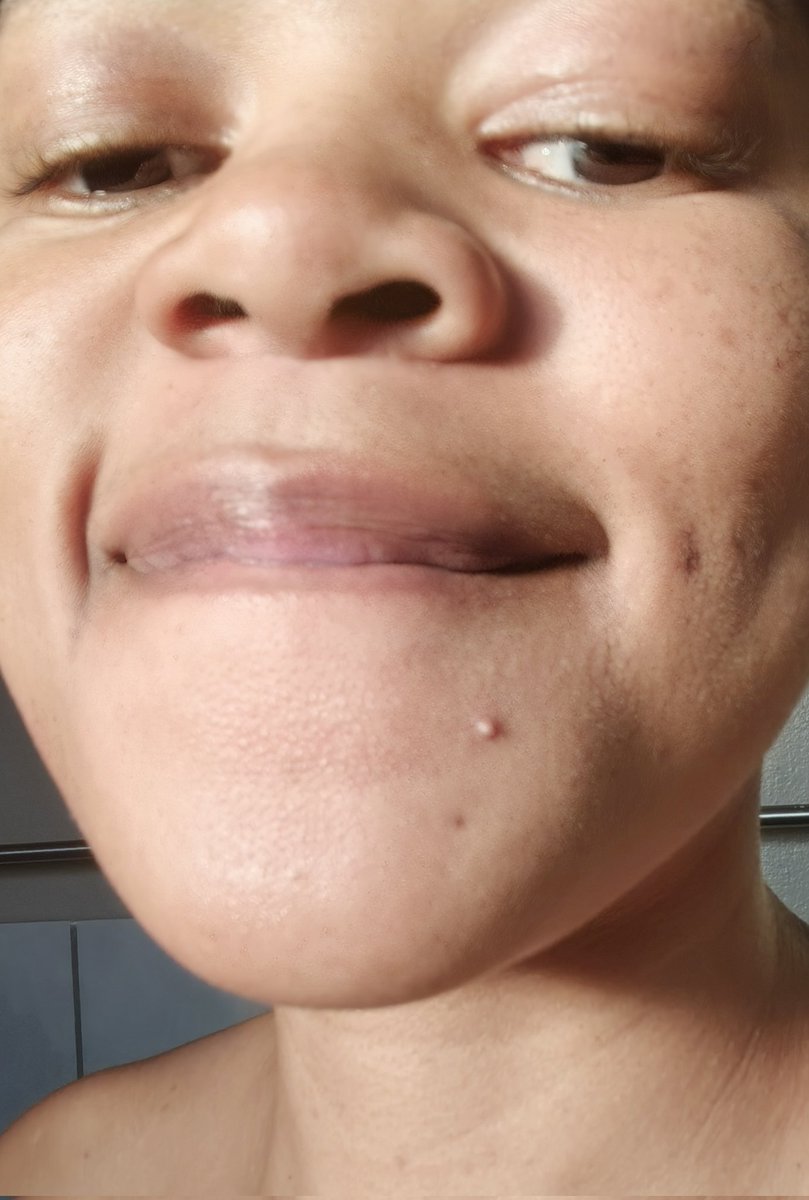 Zandile Dlamini tweet media