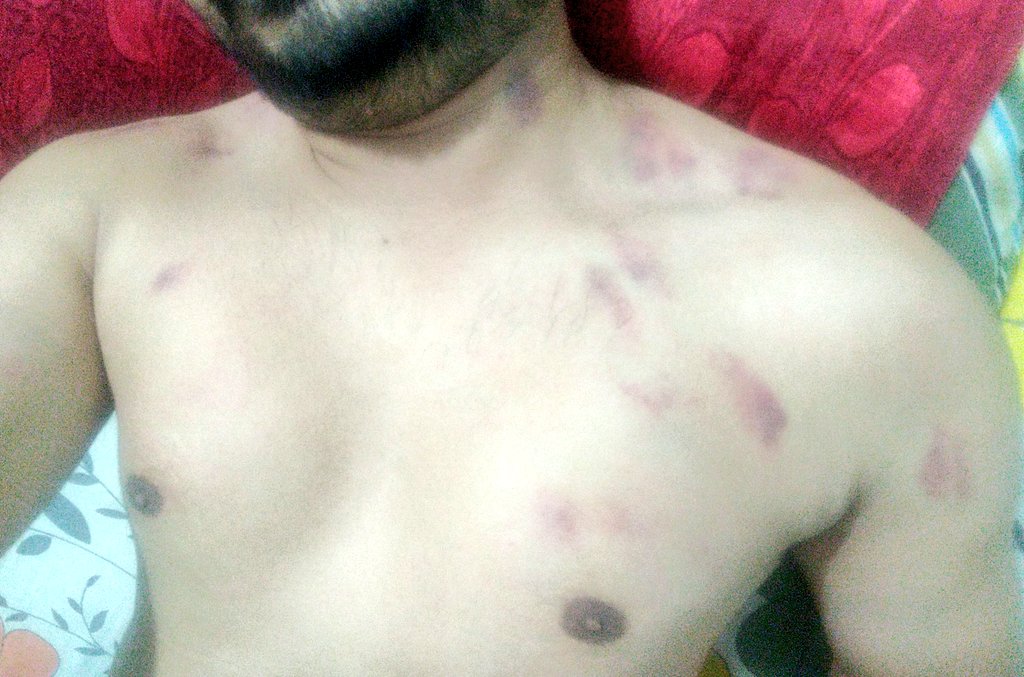 kumarYsh1995's tweet photo. Memory 
@adittyaroy2011 @C_utie08 @mearut_ka_cho @Delhi_ka_gabru @pahaditwink @prataptomar1992 @The_Dusky_Diva @wriedbeardo @Bullwbenefits @Nitinne77667089 @ssdffccf1 @hardtop7_21 @Raghavv2310 @desi7hard @twink_top09 @Tuba0797 @Desi2001boy https://t.co/8Pu7Fshgvd