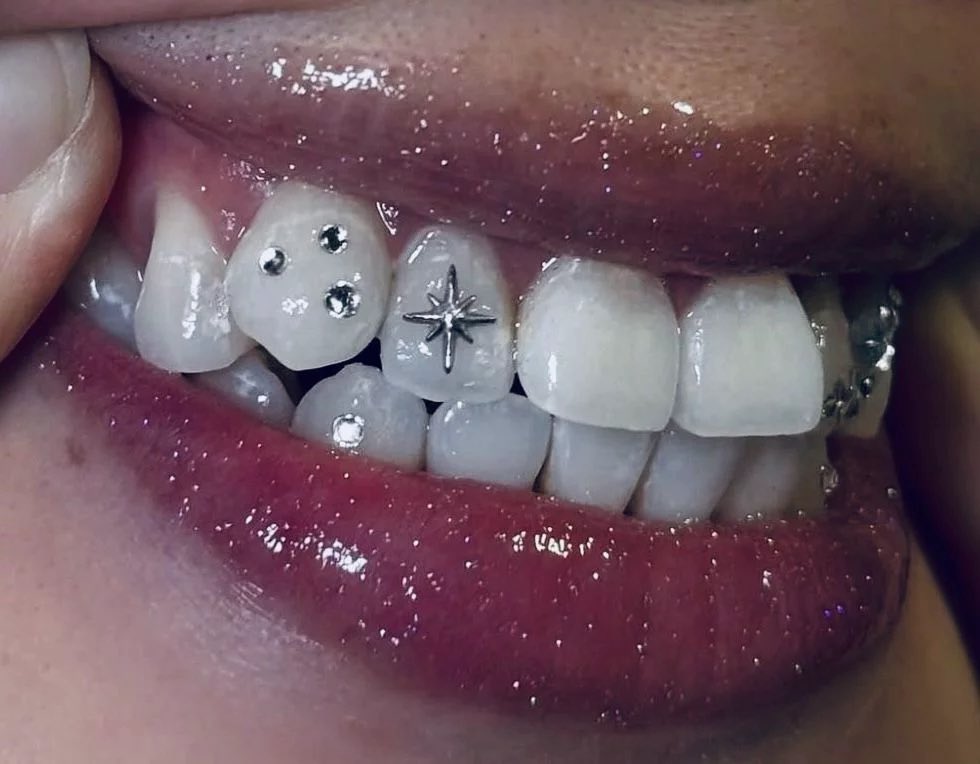 mooncookiiee's tweet photo. Thinking about getting tooth gems and a side labret https://t.co/si9zYdXJyZ