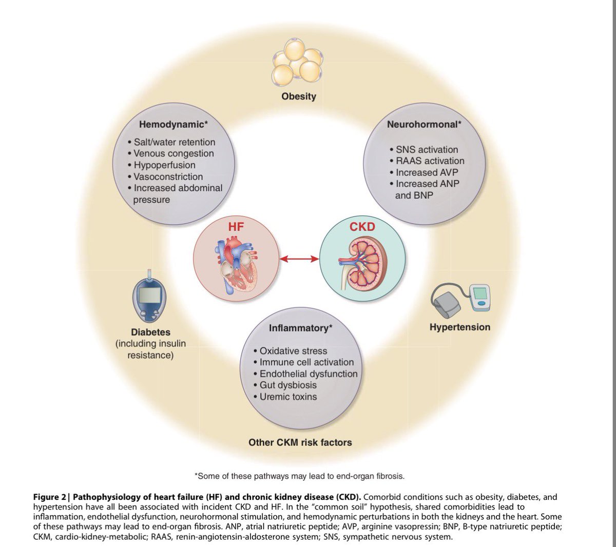 DraNefrona's tweet photo. 3 minutos nada más para recordar los inseparables ERC y falla cardiaca 😵‍💫
Las controversias de KDIGO nos dejan algoritmos y tablas super prácticos.
Vías involucradas:
🛑Neurohormonal
🛑Hemodinámica
🛑Inflamatoria https://t.co/wsJlUNsuBt