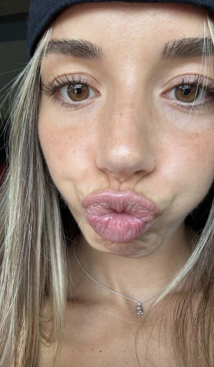 Chloe Wins U Lose✨💵 tweet media