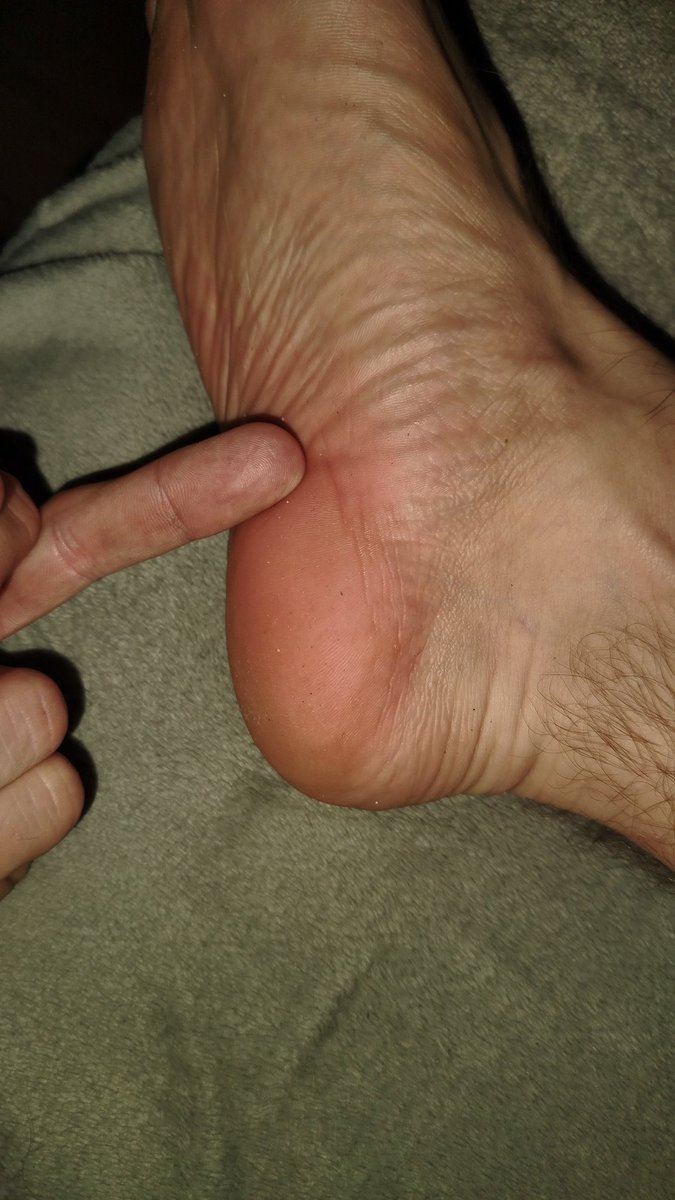 Feet Master Podkarpacie tweet media