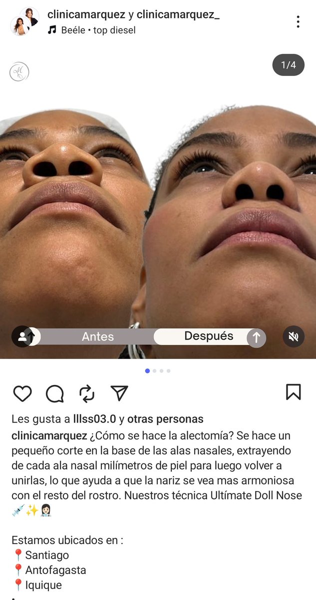 #FuttiNomy 🇨🇱 tweet media