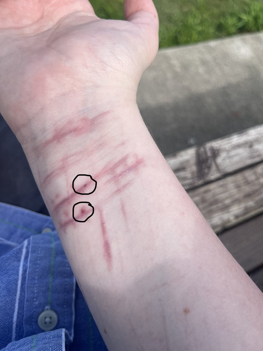 cherryytreee's tweet photo. does anyone know why there’s red spots on my healed scars all of a sudden https://t.co/kG1h7F1p7v