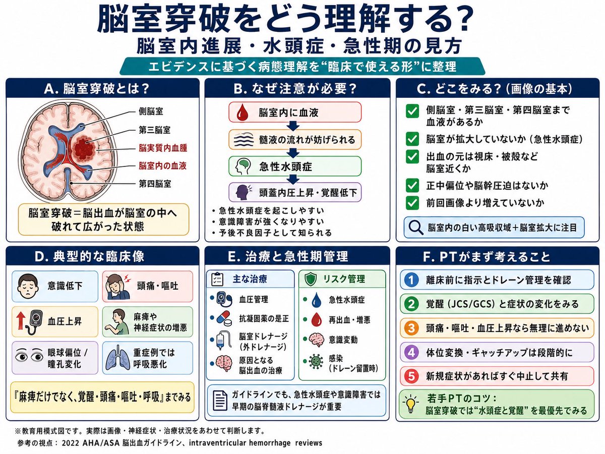 脳卒中の臨床ノートI急性期PT tweet media