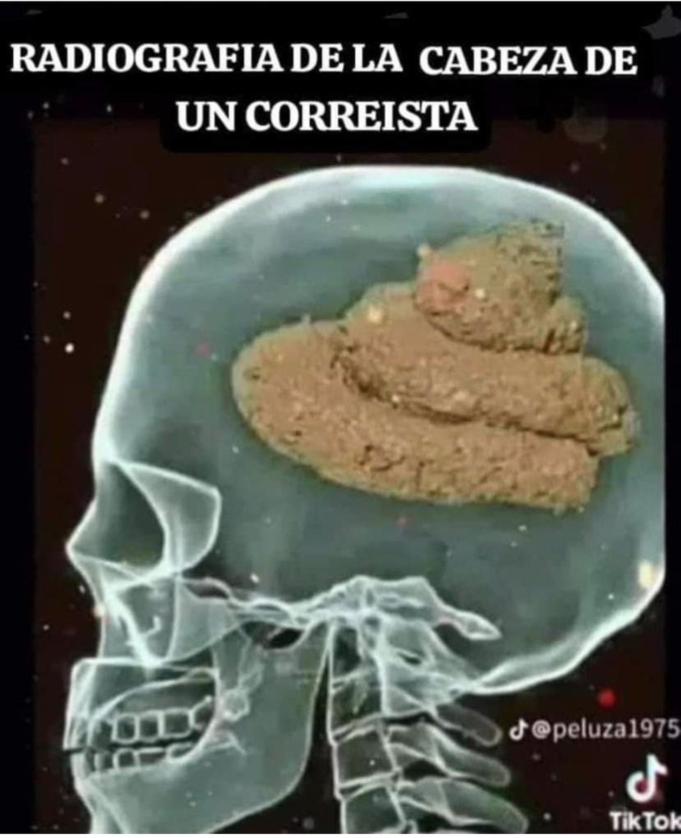 DelPatibulo's tweet photo. @Mariana99_04_14 @TeresaArboleda Toma https://t.co/x2BEHmVDOC
