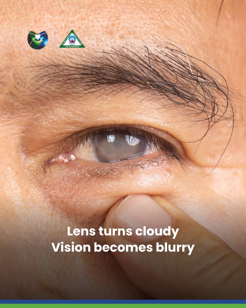MehtaEyeClinic's tweet photo. A lot of patients come to us saying "the doctor said to wait till the cataract matures." That's old thinking. Today's cataract surgery is bladeless, highly precise, and gives better outcomes when done before the cataract progresses too far. https://t.co/6PD1dlQ4sX
