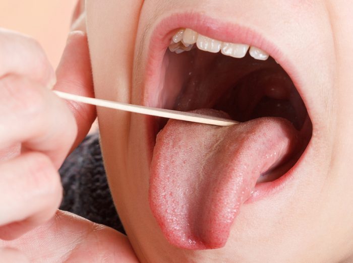 HomeopathyPlus's tweet photo. Homeopathy for Kissing Tonsils and Small Concerns.
 ‘Kissing tonsils’ describes chronically swollen tonsils so enlarged they nearly meet in the throat, often linked to repeated infections. Homeopathy looks beyond the local symptom to the whole person. Baryta carbonica is frequently indicated when this picture also includes shyness, anxiety, lack of confidence, childishness, or delayed development. Correctly matched to the individual, it can ease the tonsillar enlargement while supporting greater emotional and physical maturity. The article explains why symptom matching is essential for lasting results rather than short-term palliation. 
 https://t.co/5tSpDYcEr9
 Learn How to Use Homeopathy with our 30-Day Course: https://t.co/QLusmIodsq
#Homeopathy #KissingTonsils #Tonsillitis #BarytaCarbonica #ChildHealth #NaturalRemedies #HolisticHealth #HomeopathicMedicine
