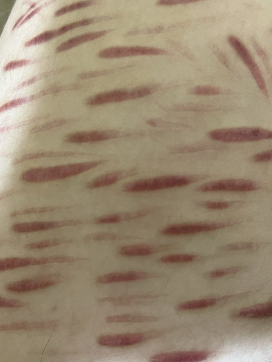 ݁ ⊹ 𝘥𝘳𝘢𝘤𝘰 𝘮𝘢𝘭𝘧𝘰𝘺 𝘰𝘧 🔪𝘵𝘸𝘵 ⊹ ݁ tweet media