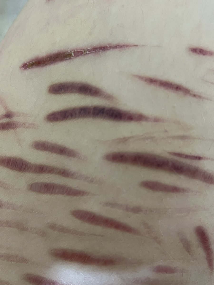 ݁ ⊹ 𝘥𝘳𝘢𝘤𝘰 𝘮𝘢𝘭𝘧𝘰𝘺 𝘰𝘧 🔪𝘵𝘸𝘵 ⊹ ݁ tweet media