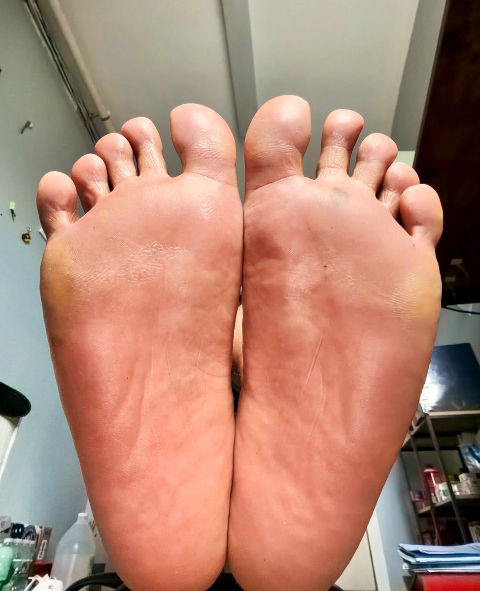 SoleMatesCT's tweet photo. On my 15 showing off these overtime survivors 😏👣 ✨ #FootTwitter #Soles #MaleFeet #FeetPics #FootContent #SexyFeet #WorkFeet #BareSoles #CallusedFeet #FootLover #GayTwitter #ThickGuys #SoleMatesCT #FootFetish #FootModel #FeetCommunity #BlueCollarMen #MensFeet #FootGuys #ToeDay https://t.co/mIj1QSMZZC