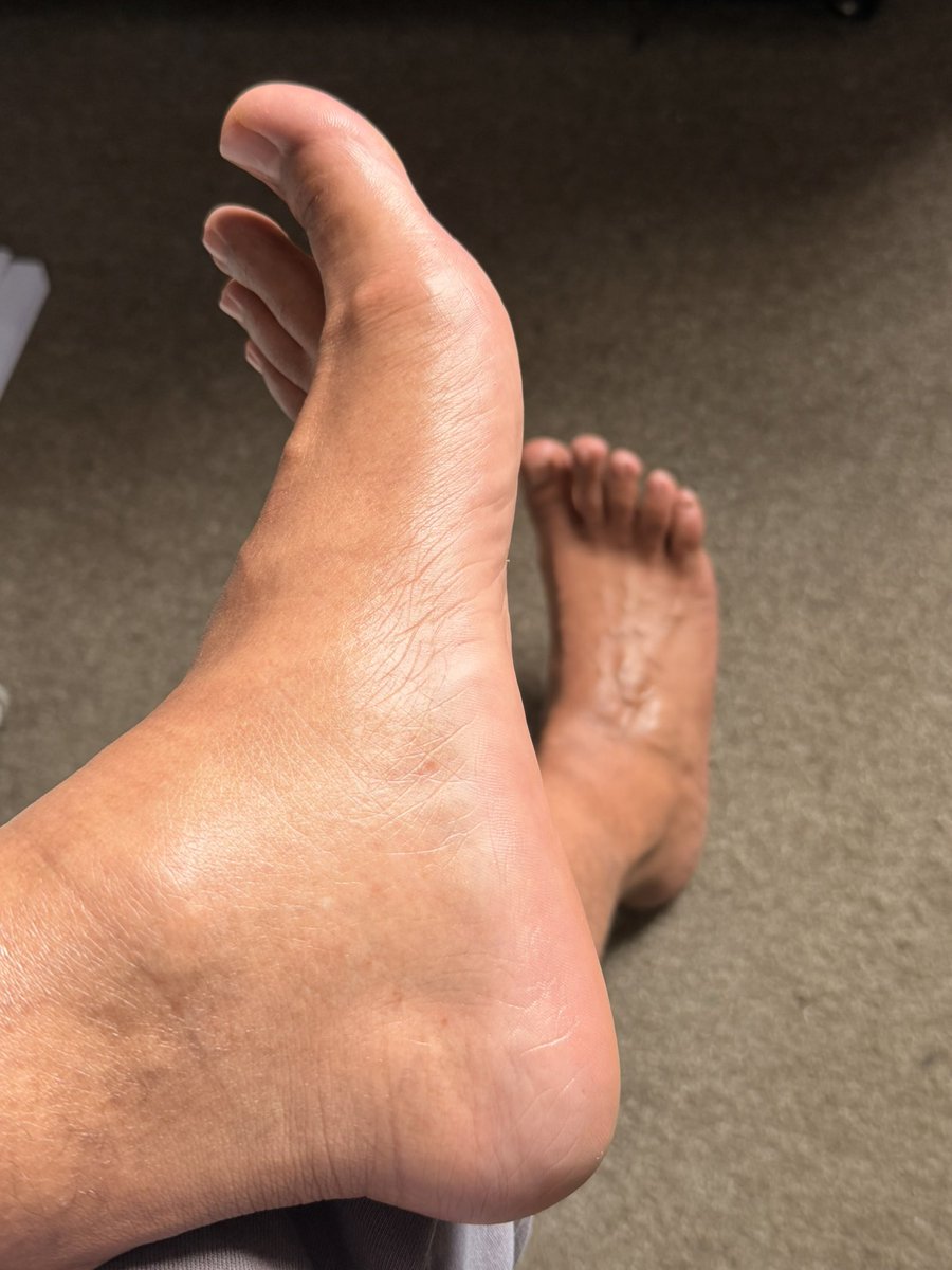 SoleMatesCT's tweet photo. On my 15 showing off these overtime survivors 😏👣 ✨ #FootTwitter #Soles #MaleFeet #FeetPics #FootContent #SexyFeet #WorkFeet #BareSoles #CallusedFeet #FootLover #GayTwitter #ThickGuys #SoleMatesCT #FootFetish #FootModel #FeetCommunity #BlueCollarMen #MensFeet #FootGuys #ToeDay https://t.co/mIj1QSMZZC