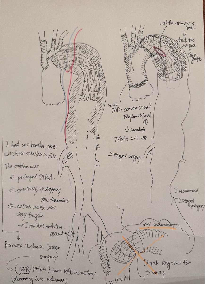 大島 晋 | 大動脈外科 (Susumu Oshima | Aortic surgery) tweet media
