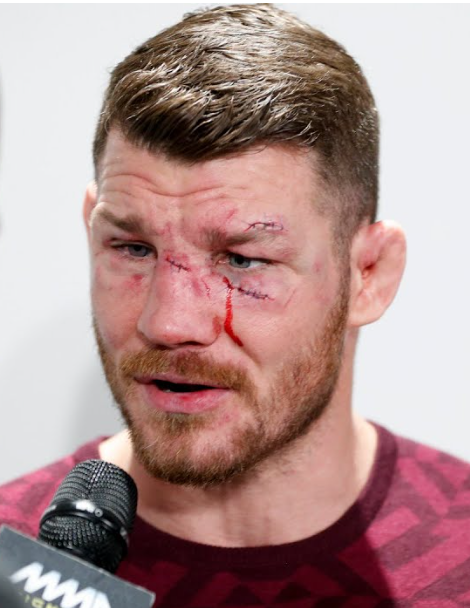 d33_jordy's tweet photo. @bisping Renowned Dermatologist and skin cancer specialist, Dr Michael Bisping. https://t.co/gucxVzpfyO