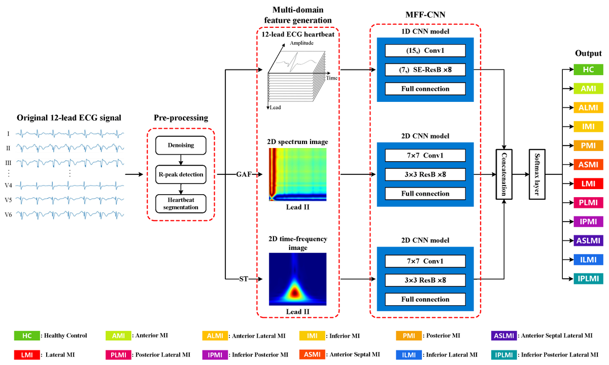 Biosensors_MDPI's tweet photo. 📣Call for Reading:

#Article

A Multi-Domain Feature Fusion CNN for Myocardial Infarction Detection and Localization

By Yunfan Chen, Jinxing Ye, Yuting Li, Zhe Luo, Jieqiang Luo, Xiangkui Wan

#deep_learning #ECG #biosensor #open_access https://t.co/lPnFPYKDtx