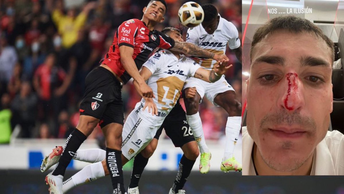 TitanOcc's tweet photo. @LigaBBVAMX @PumasMX Como cuando salvamos el fútbol mexicano de esos nacos, iracundos, ordinarios y apestosos Pumas... y nos llamaban “Ratlas”.

De nada, Liga MX. 😎 https://t.co/Yl2avxLdiu