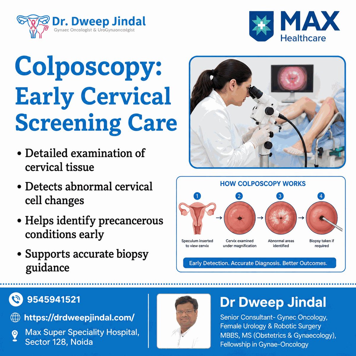 dweepjindal24's tweet photo. Abnormal cervical screening results may require closer evaluation with colposcopy. Early detection helps identify changes before they progress further. #Colposcopy #CervicalHealth #GynaeOncology #CancerScreening #WomensHealth #EarlyDetection #delhincroncology #maxnoida https://t.co/gFgWQkLkxq