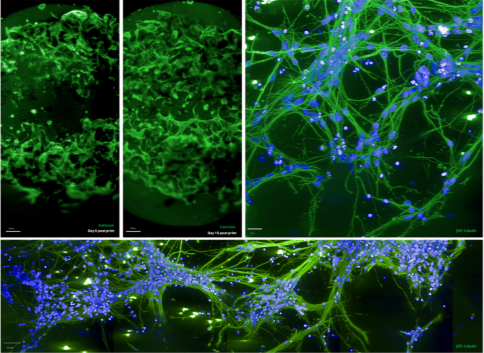 Bioeng_MDPI's tweet photo. 💥Excited for the publication: "Investigating Connectivity Deficits in Alzheimer&amp;rsquo;s Disease Using a Novel 3D Bioprinted Model Designed to Quantify Neurite Outgrowth"
🔗https://t.co/qLH0b5IQOg
📌 #Alzheimers #3DBioprinting #Neuroscience #StemCells #TissueEngineering #iPSC https://t.co/BkwHL0VOdO