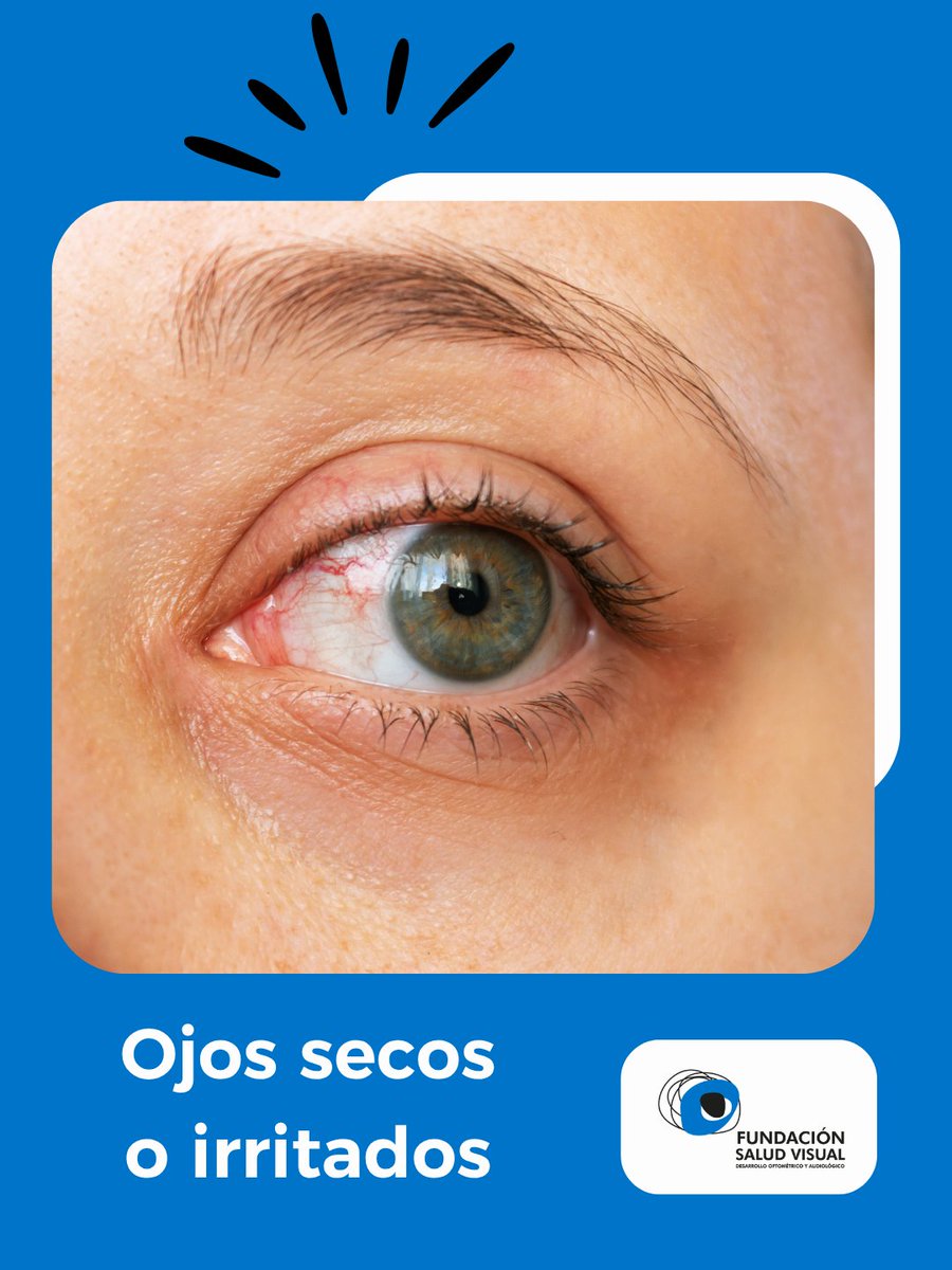 funsavi's tweet photo. 👁️⚠️ Si experimentas estos síntomas, puede que estés forzando tu visión.

Haz pausas, ajusta la iluminación y consulta a un profesional si las molestias persisten.

#Funsavi #Visión #SaludVisual https://t.co/3EZKwzt6wj