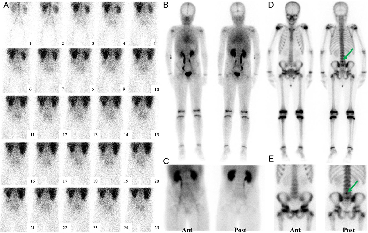 Clinical Nuclear Medicine tweet media