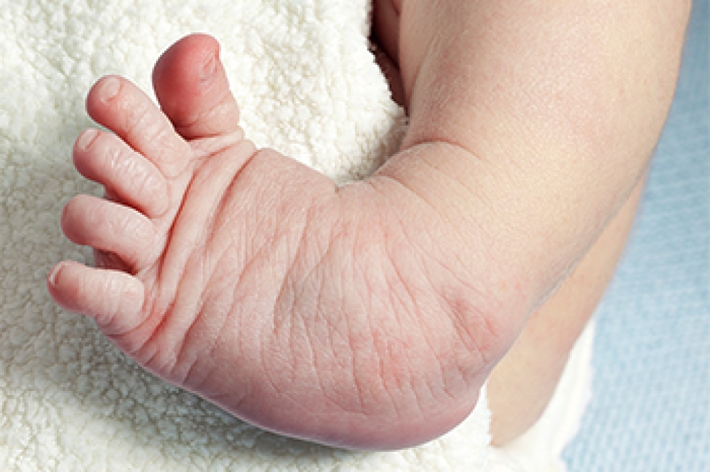 Elite_Podiatry's tweet photo. When a Child's Feet Develop Differently https://t.co/kREbMTs10a https://t.co/6SKavcwkAx