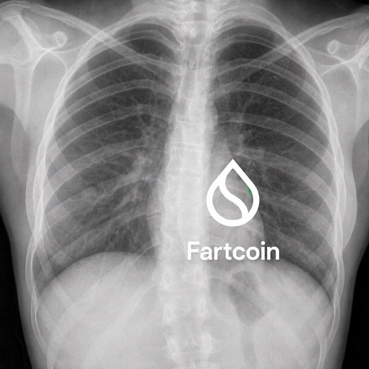 stallycrypto's tweet photo. @SuiInsiders @SuiNetwork Fartcoin forsure @suifartcoin 

Recently launched a beta version of Fartpad w a coin pared with @flushwtf 

With many more utilities ready to tie in, the fartenning is inevitable https://t.co/FgfGtgcvxn https://t.co/uVFVWX2glD