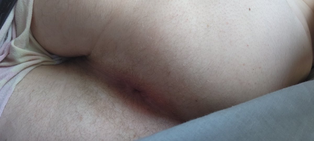 nickynoly's tweet photo. @BoCoCPL Hairy https://t.co/nO1zM4OF9g