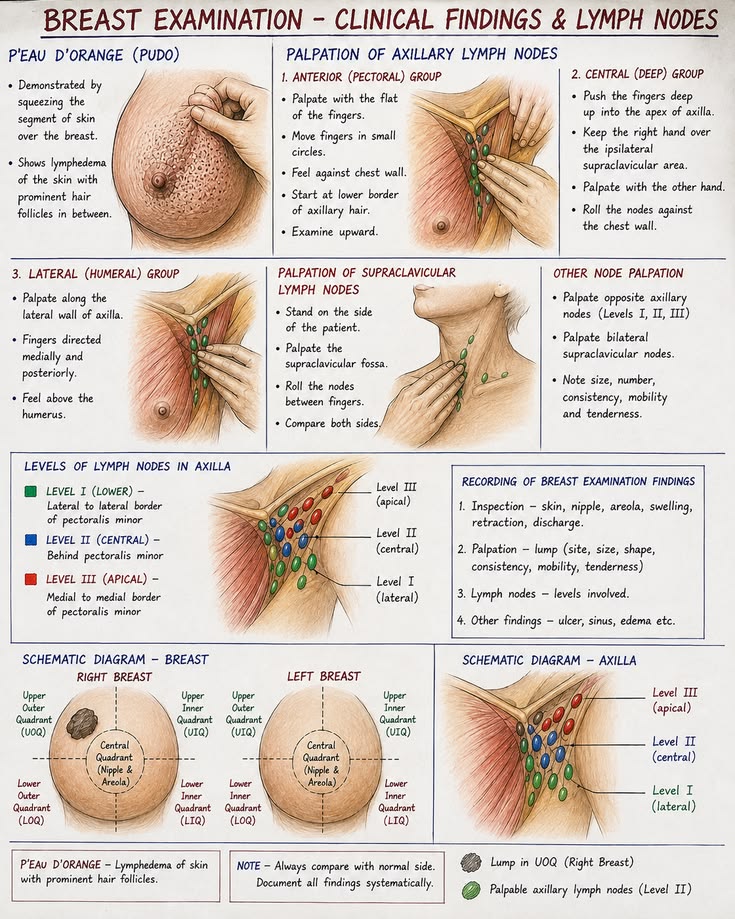 MededDaily42640's tweet photo. BREAST EXAMINATION https://t.co/JIueCi3MW5