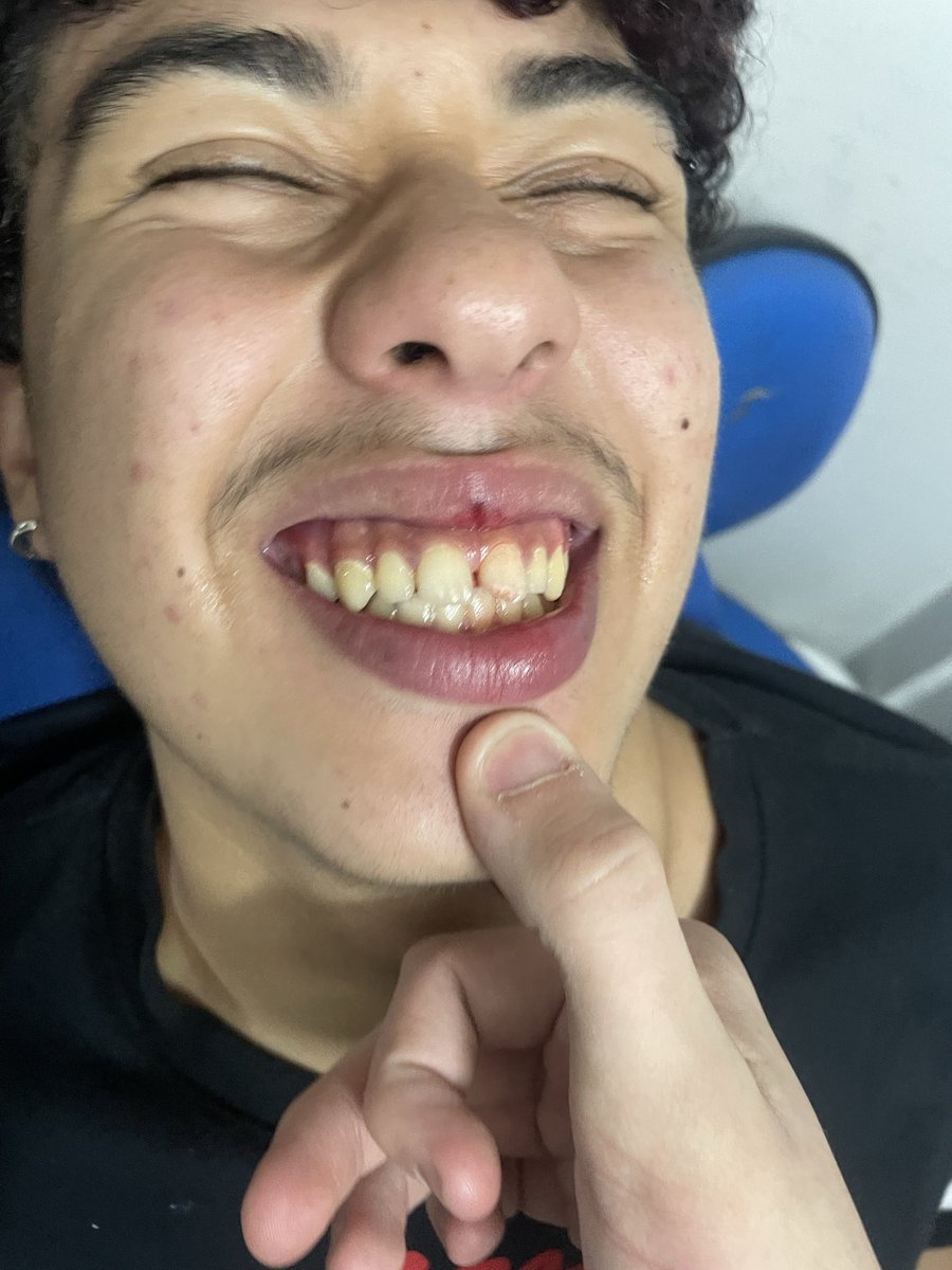 OnlyVallk's tweet photo. @YamiShi2429 quebrou o dente ai viado? KKKKKKKKKKKKKKK https://t.co/Qp9ygGiQil