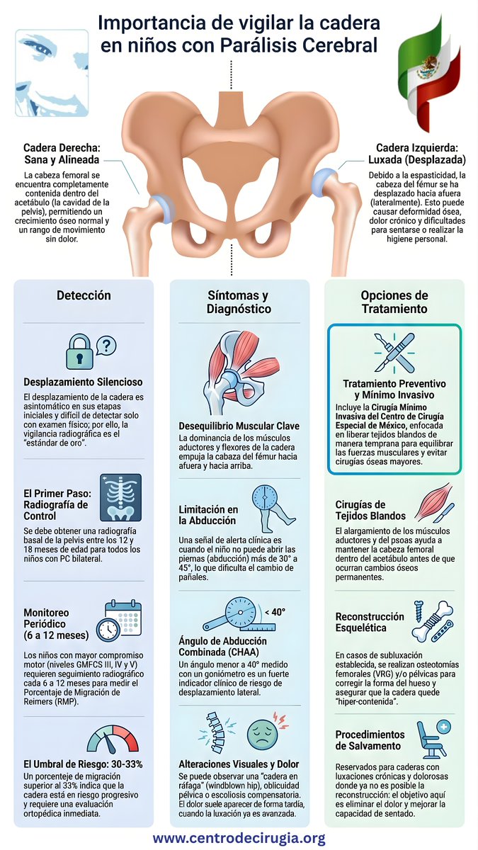 ccemiap's tweet photo. Cuidar las caderas en niños con Parálisis Cerebral
Muchas complicaciones graves de cadera se pueden prevenir… si actuamos a tiempo.
@CP_Sport @CPInfo @WorldCPDay #ParálisisCerebral #fypシ゚viral https://t.co/VDbqdg6ASH https://t.co/9qB2AQHHFS