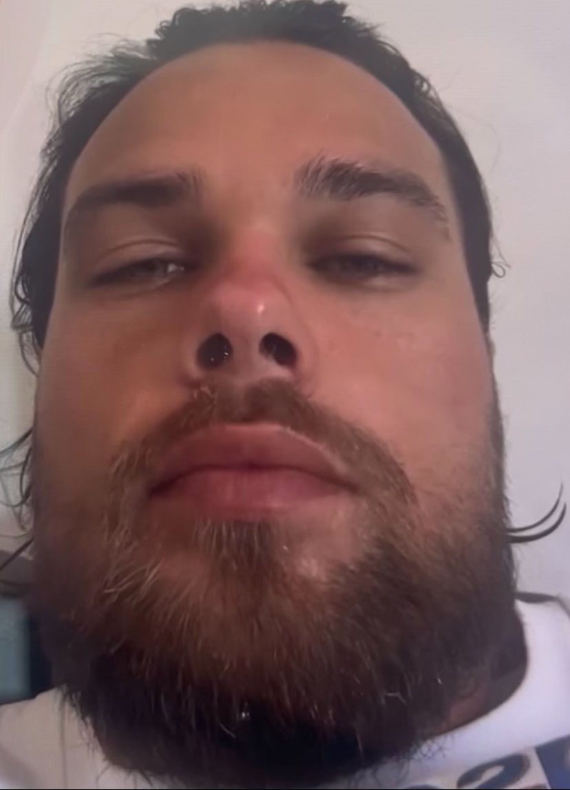 PaulineBottalla's tweet photo. Quelqu’un ma envoyé une vidéo de mon petit frère Pierre René Bottalla qui prend de la cocaine . Il avait laisser sa caméra allumer ou il s’est fait pirater visiblement … https://t.co/Dx9ZQ2SiX0