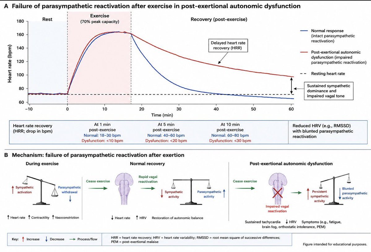 AutonomicBrad77's tweet photo. Failure of Parasympathetic Reactivation after Exercise in Long Covid Patients. #LongCovid #pwME #pwLC #Dysautonomia #POTS https://t.co/hoT2Ud5jYC