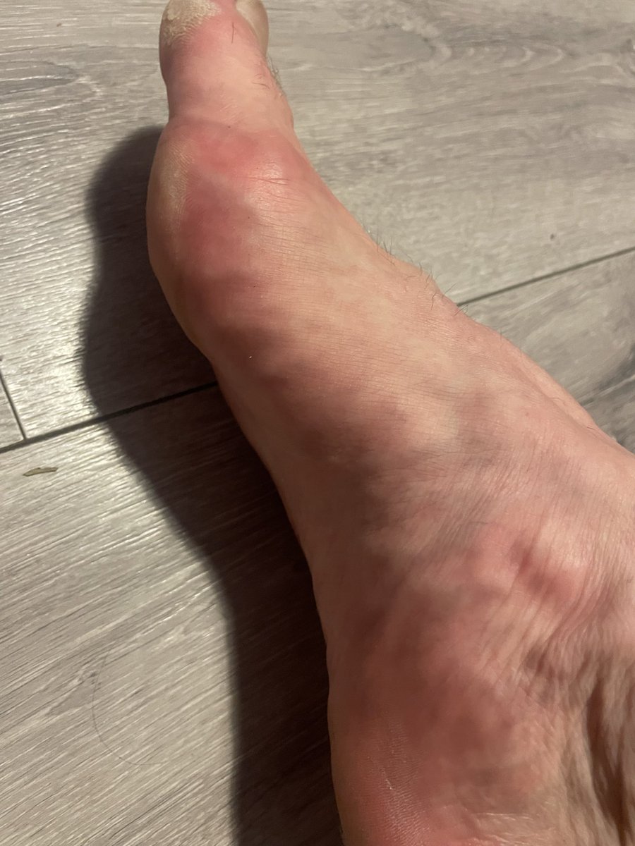 Size12prince's tweet photo. My poor big feet have been really busy they really need a rub #feetfetısh #bigfeet #feetworshi̇p #bigfoot https://t.co/iHhgxFN1YF