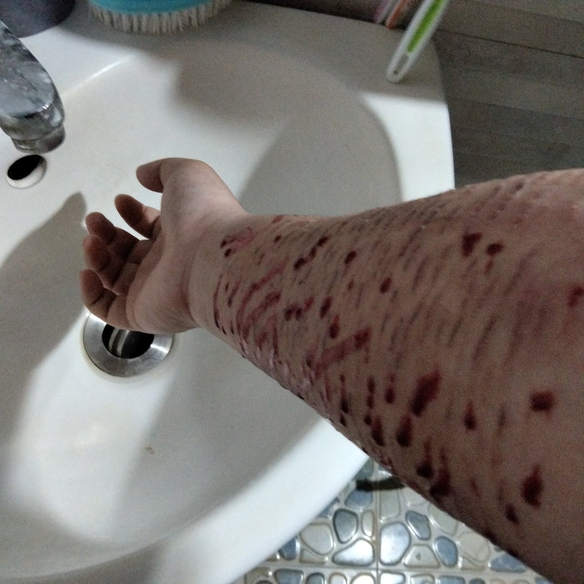 Shunn1512's tweet photo. không ngủ được. #selfharm #sh #vent https://t.co/BWIJgHXfLT