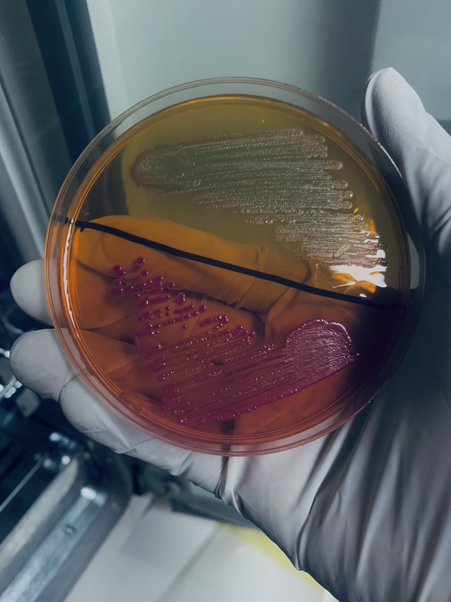 Softmedic's tweet photo. My streak game, pick your best.
Frame 1: Salmonella and E.coli on DCA, hektoen and  0157 chromogenic agar
Frame 2: Leuconostoc mesenteroides  cremoris
Frame 3:  E.coli &amp; Salmonella on Mac
Frame 4: E.coli (lacks lactose permease) on Cled https://t.co/Aav1XZH19E