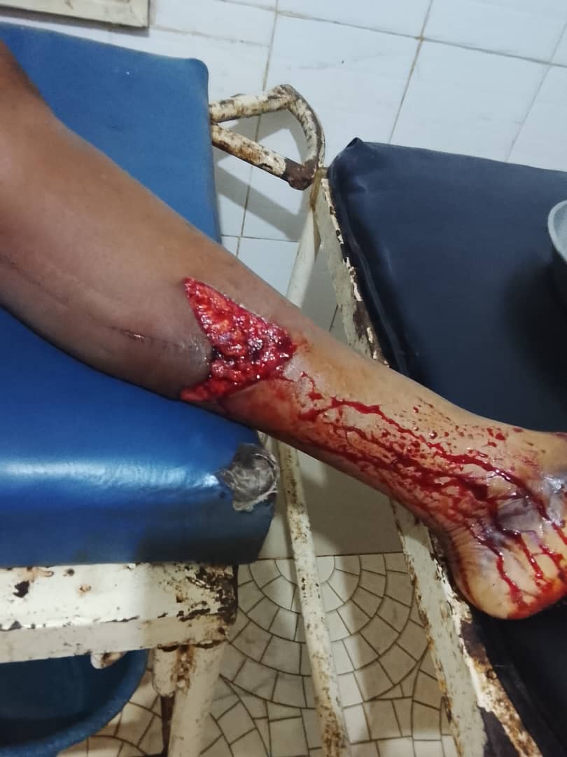 donmike001's tweet photo. @officialmoore7 please help me, my mom had an accident. Please moore, am in lagos in search of job https://t.co/gcDTqGSjMk