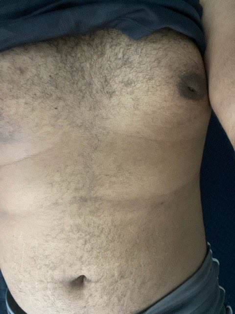 SoftCub_'s tweet photo. Não tenho muito pelo 🥺🤏🏽🐻

—

I don't have enough hair 🥺🤏🏽🐻 https://t.co/yXEvJNtLIg