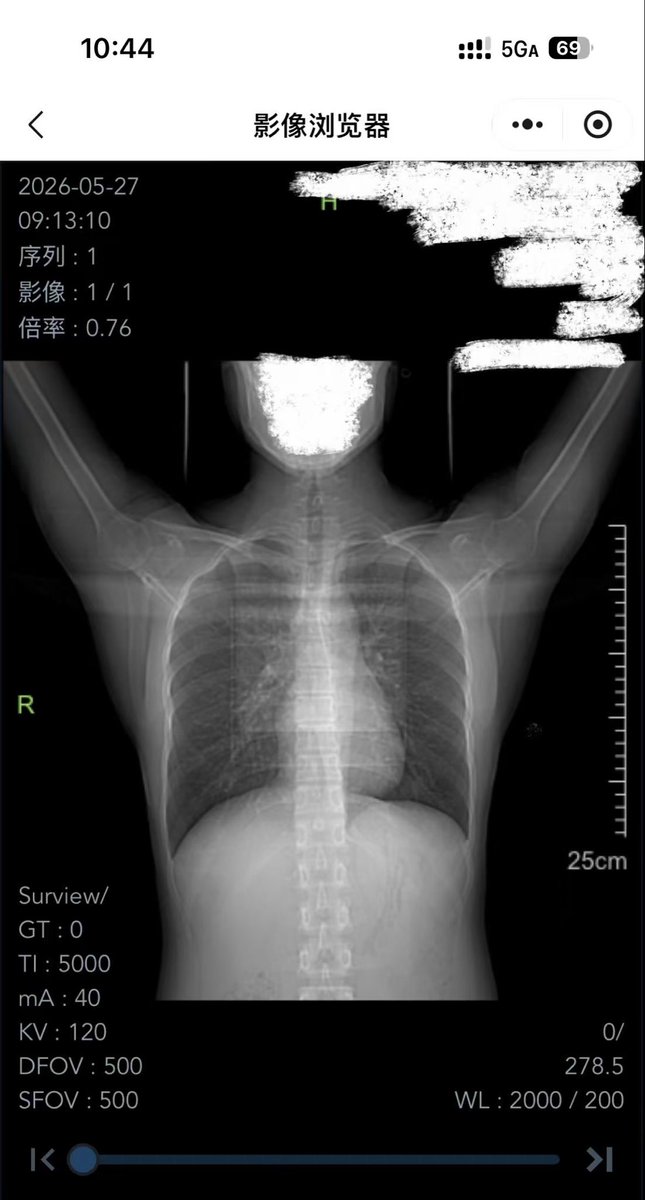 玻珈雲音 tweet media
