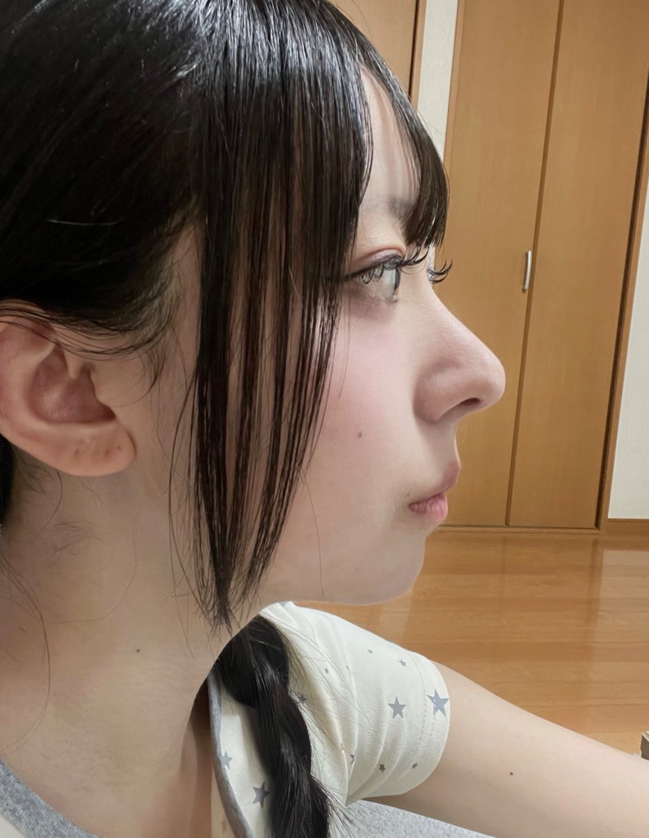 うい 鼻DT 8月脂肪吸引🇰🇷 tweet media