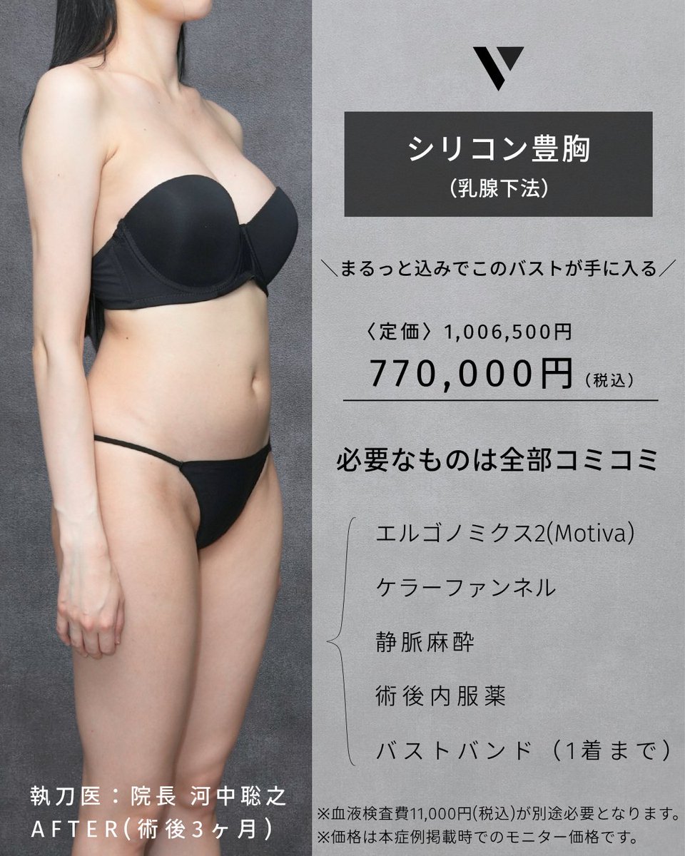 vertraclinic's tweet photo. 《 施術内容 》
シリコン豊胸(乳腺下法)

《 執刀医 》
大阪院院長 河中 聡之(@Dr_kawanaka)

《 詳細 》
女性/20代/157cm/41kg
シリコンバッグ：motiva エルゴノミクス2
シリコンサイズ：MINI 235cc
挿入部位：脇下 https://t.co/hjejsAqCSs