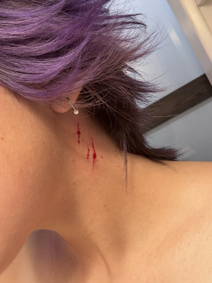 ellixbeez's tweet photo. neck cuts (cat scratches) cus ive been wanting to do this bur like school was preventing me BuT its summer now and only on da sides cusss i WILL get sent to the ward 😂😂 #shtwt #shedtwt https://t.co/A3xsWKlP6p