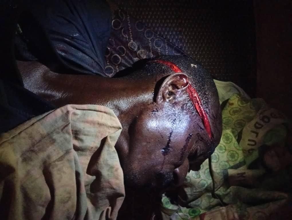 USBiafraFirst's tweet photo. The killing in Nigeria Terr0rist State intensify. https://t.co/Stb3rL1VpP