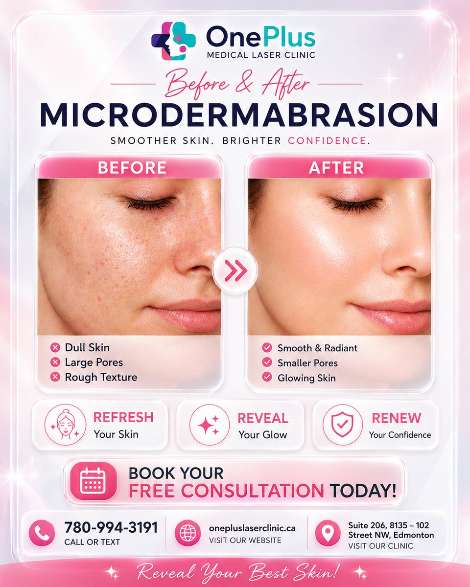 Luckybean17's tweet photo. 🔬 Real Results, Trusted Experts.Swipe left to see the transformation

⬅️.Our Microdermabrasion treatment targets rough texture and uneven skin tone at the source, stimulating collagen and revealing a brighter, smoother you.

📍 Visit us: Suite 206, 8135 – 102 Street NW, https://t.co/c15IWL9xqz