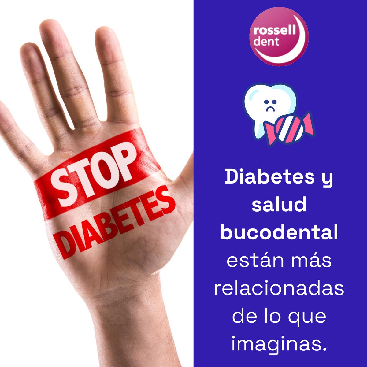 rosselldent's tweet photo. 🩺🦷#Diabetes y #saludbucal van de la mano

⚠️#Encías sensibles, #infecciones o #sequedad pueden aparecer
💡Cuidar tu #boca también protege tu bienestar

👉Pide tu cita hoy
🖥️https://t.co/6530F7eVGD

#Periodontitis #EncíasSanas #Dentista #ClinicaDental #PrevencionDental https://t.co/tFPQXkk1BO